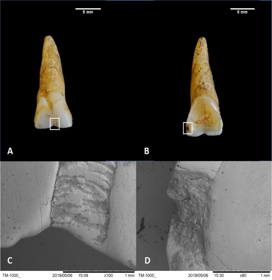 Evidence for Teeth-as-Tools and Palliative Oral Hygiene at Late ...